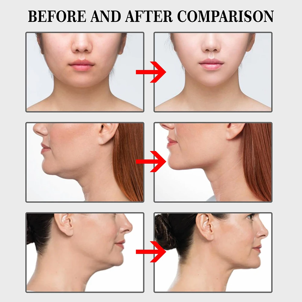 V-Shaped stiker adesivi invisibili per lifting viso 100 pz image 3