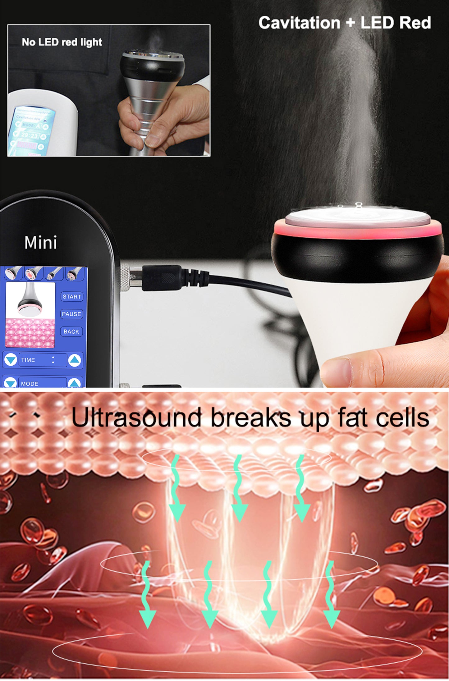 4 in 1 Facial Care 40K Cavitation Lipo Slimming Ultrasonic Liposuction Cavitatio image 10