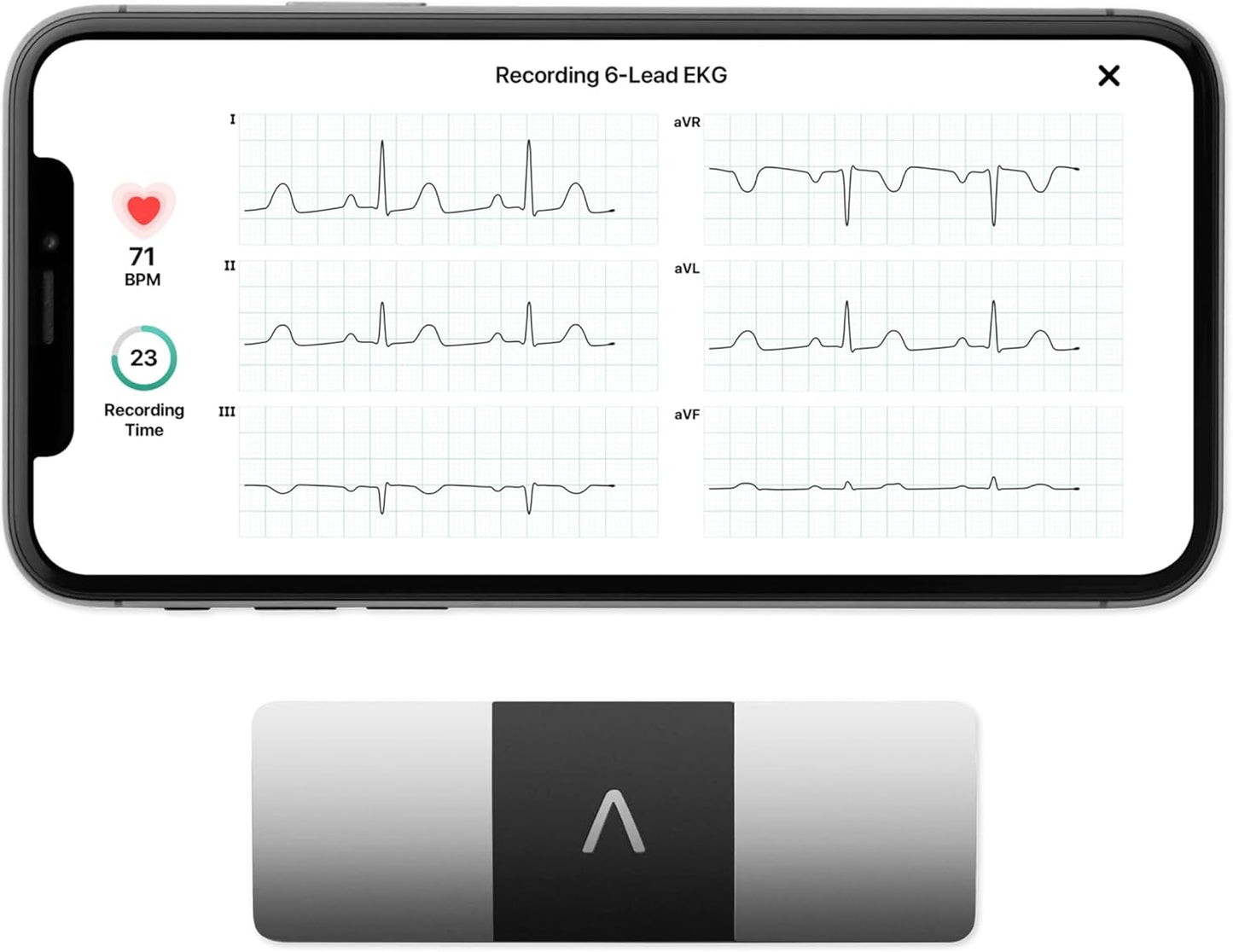 AliveCor KardiaMobile 6L ECG Portatile a 6 Derivazioni image 1