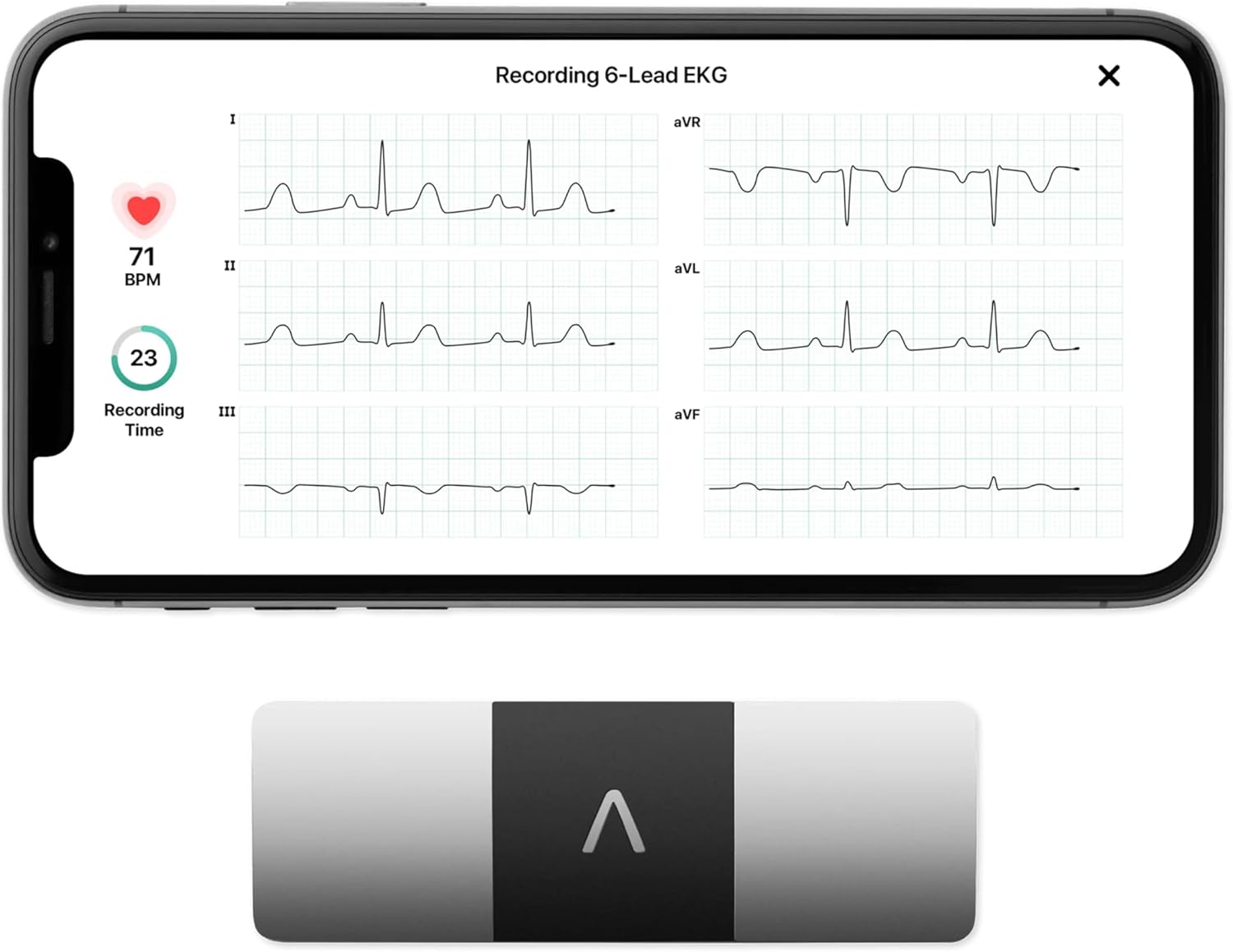 AliveCor KardiaMobile 6L ECG Portatile a 6 Derivazioni image 1