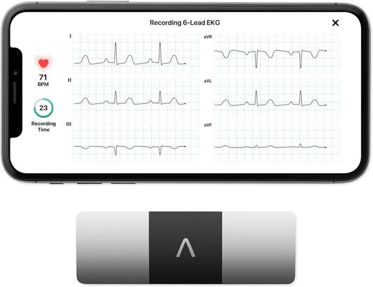 AliveCor KardiaMobile 6L ECG Portatile a 6 Derivazioni image 1