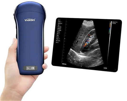 Viatom Ecografo portatile wireless 3 in 1 con sonda lineare, convex e cardiaca image 0